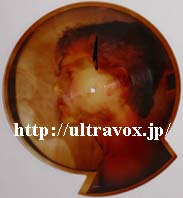 Like A Miracle (7inch Shaped Picture)